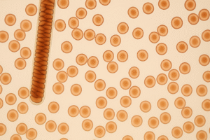 what is the esr level in cancer patients